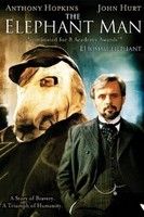 Az elefántember (1980) online film